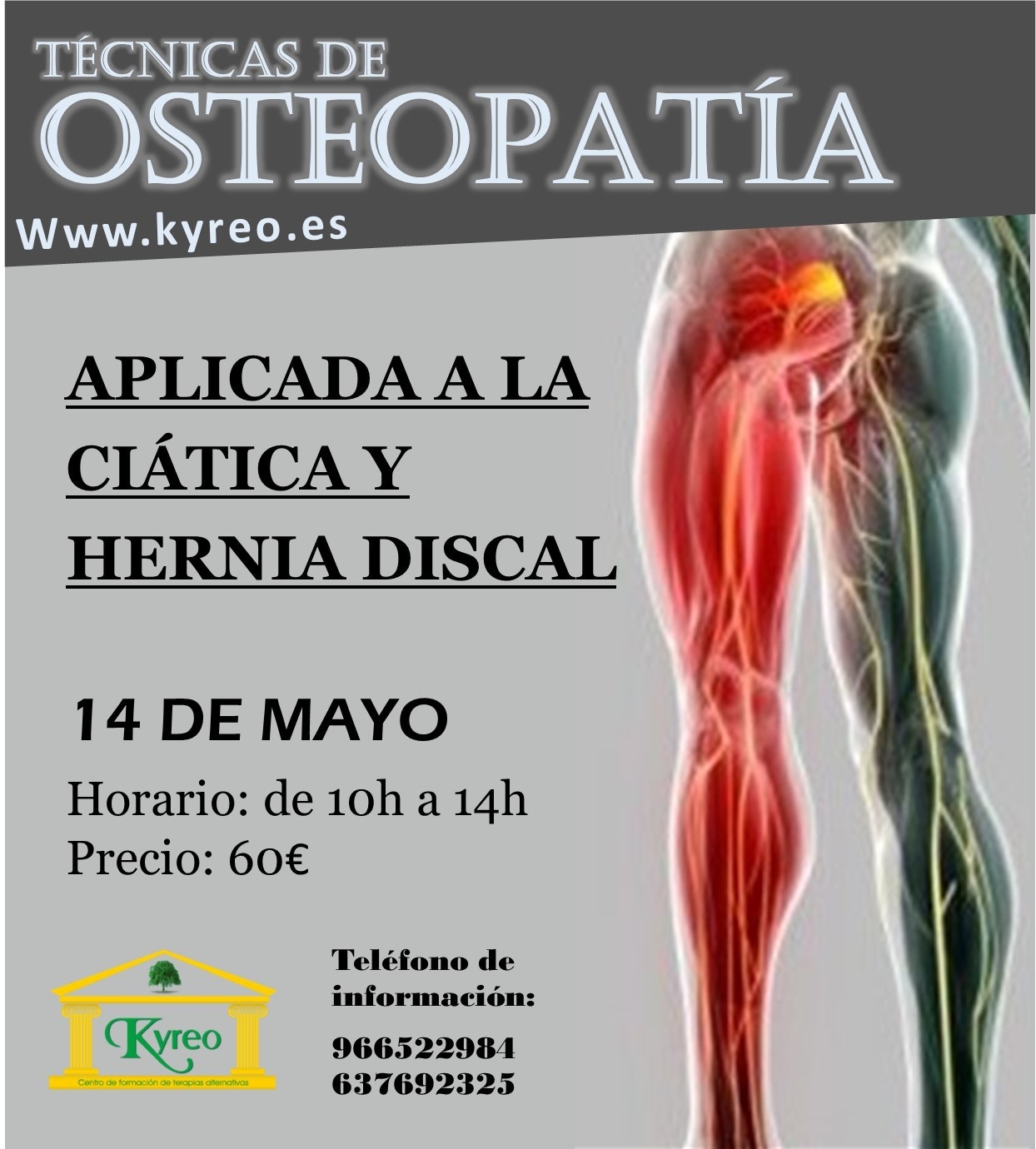Técnicas de Osteopatía para la ciática y las hernias discales Kyreo