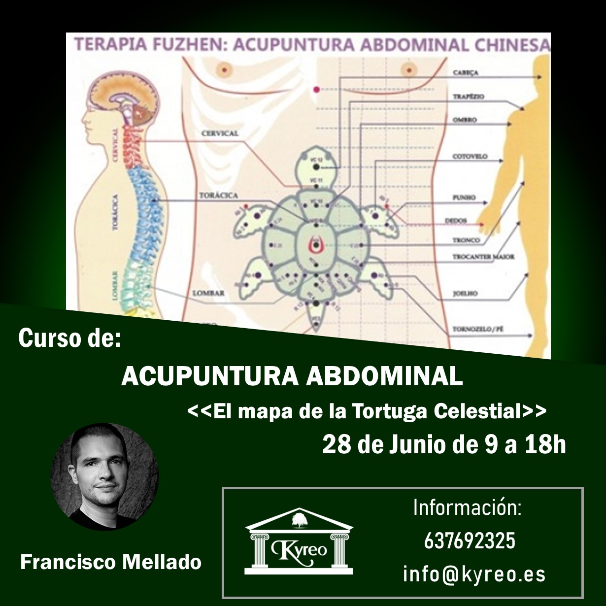Acupuntura Abdominal