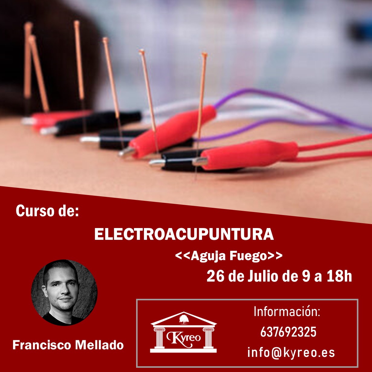 Curso de Electroacupuntura en Kyreo